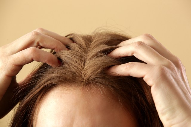 An image of a woman itching her scalp