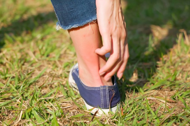 An image of a person scratching their ankle