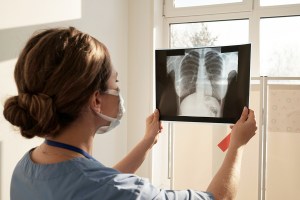 Doctor holding up an x-ray of a patient's chest
