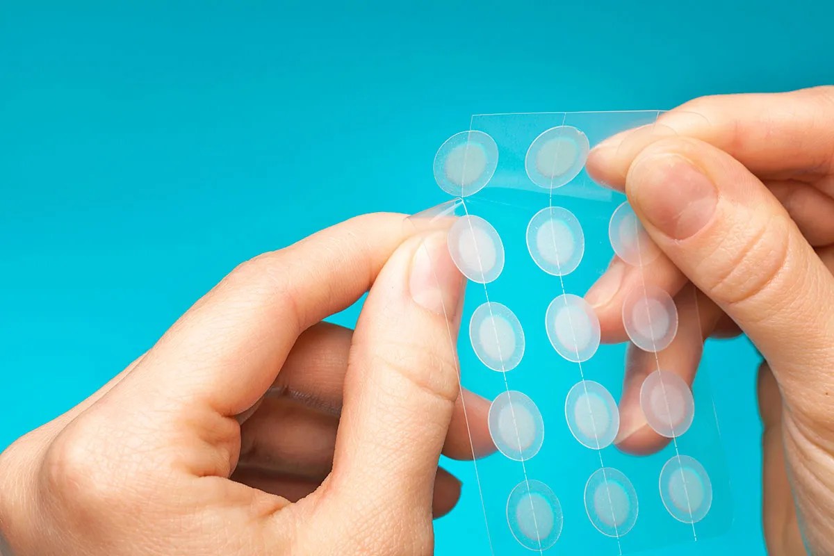 Close-up of acne patches for treatment of pimples and blemishes 
